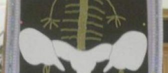 Makarnadan İskelet…