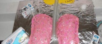 Sağlıklı Sağlıksız Akciğerler :)